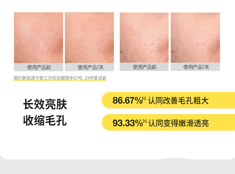 羽素毛孔收敛水去闭口控油无酸可湿敷收缩毛孔精萃爽肤水护肤补水 祛痘精华15ml+水200ml