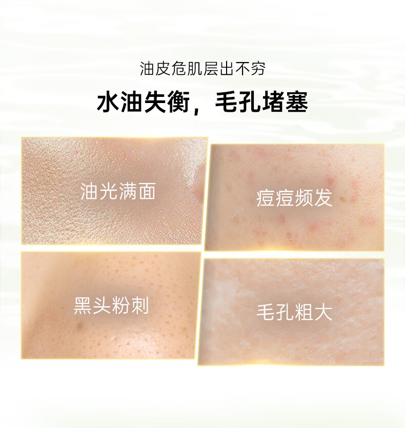 泊美（PURE＆MILD）控油护肤品套装水乳去角质补水保湿精华清痘淡化痘印收缩毛孔七夕 净痘水+净痘乳