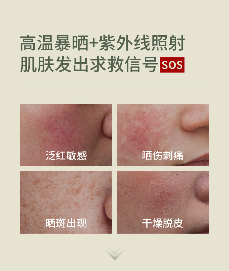 SKISGEM原装进口晒后修复芦荟凝胶补水面部肌肤晒伤急救全身男女士 晒后修护100g