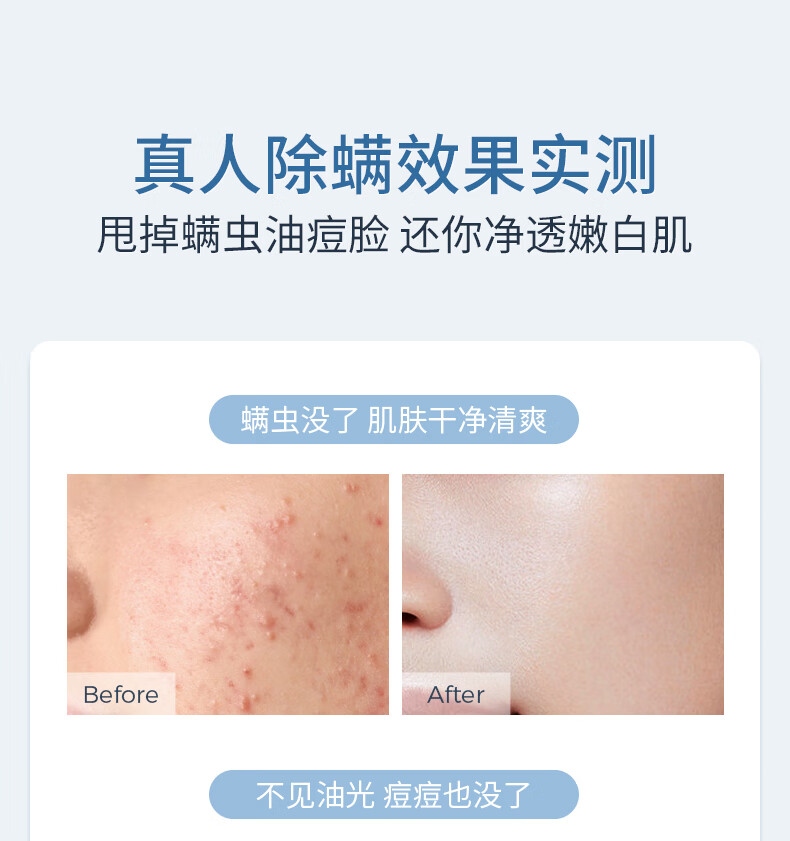 EXPRESSIONS新加坡进口氨基酸除螨洗面奶控油祛痘去黑头收缩清洁毛孔洁面乳 氨基酸洁面乳120g
