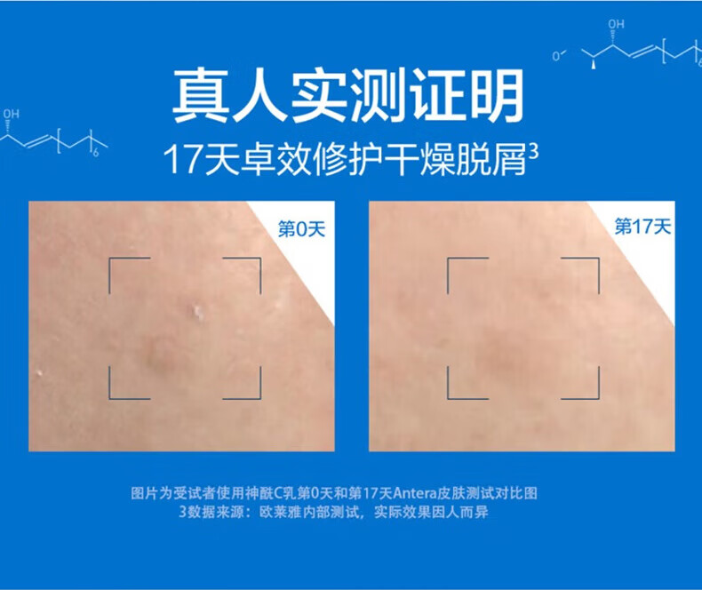 适乐肤（CeraVe）美国版滋润补水保湿身体乳C霜C乳修复润肤提亮男女护肤品神经酰胺 保湿修护屏障敏感肌身体乳473ml
