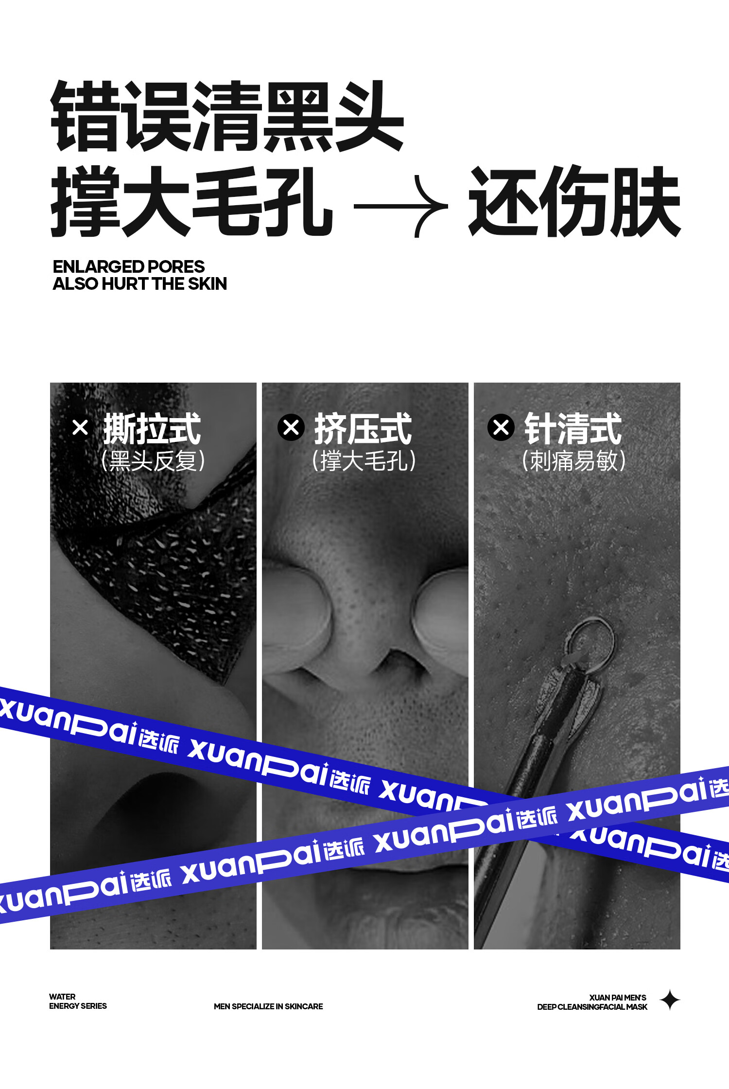 选派鼻贴去黑头粉刺深层清洁毛孔草莓鼻男女士专用 1盒 5组10片/盒