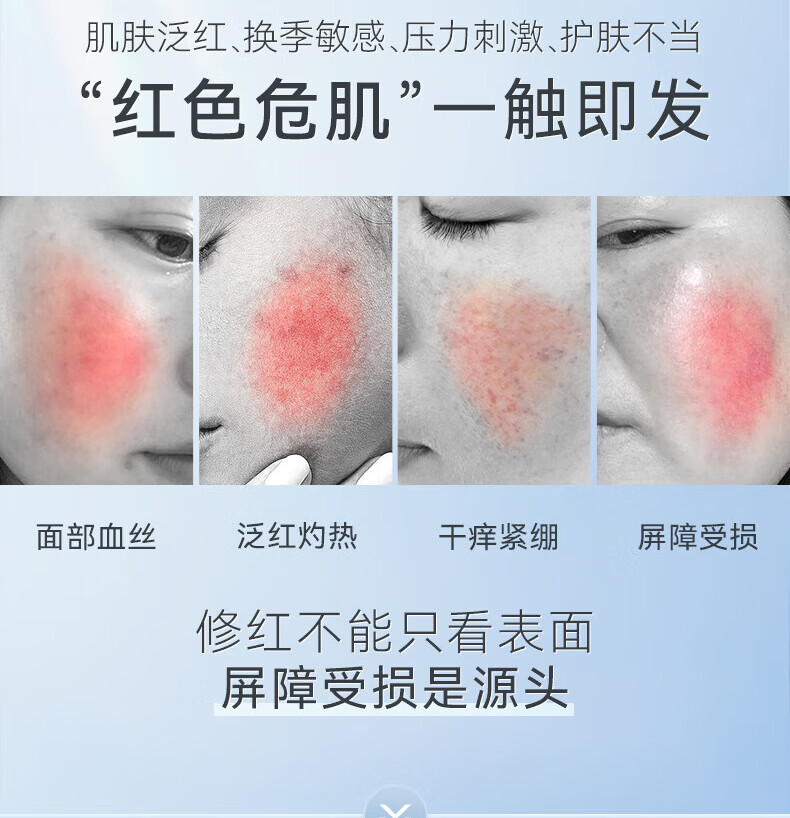 RSAS 舒缓精华 红血丝修复角质层修护屏障 敏感肌专用护肤品 舒缓保湿倍护霜30g