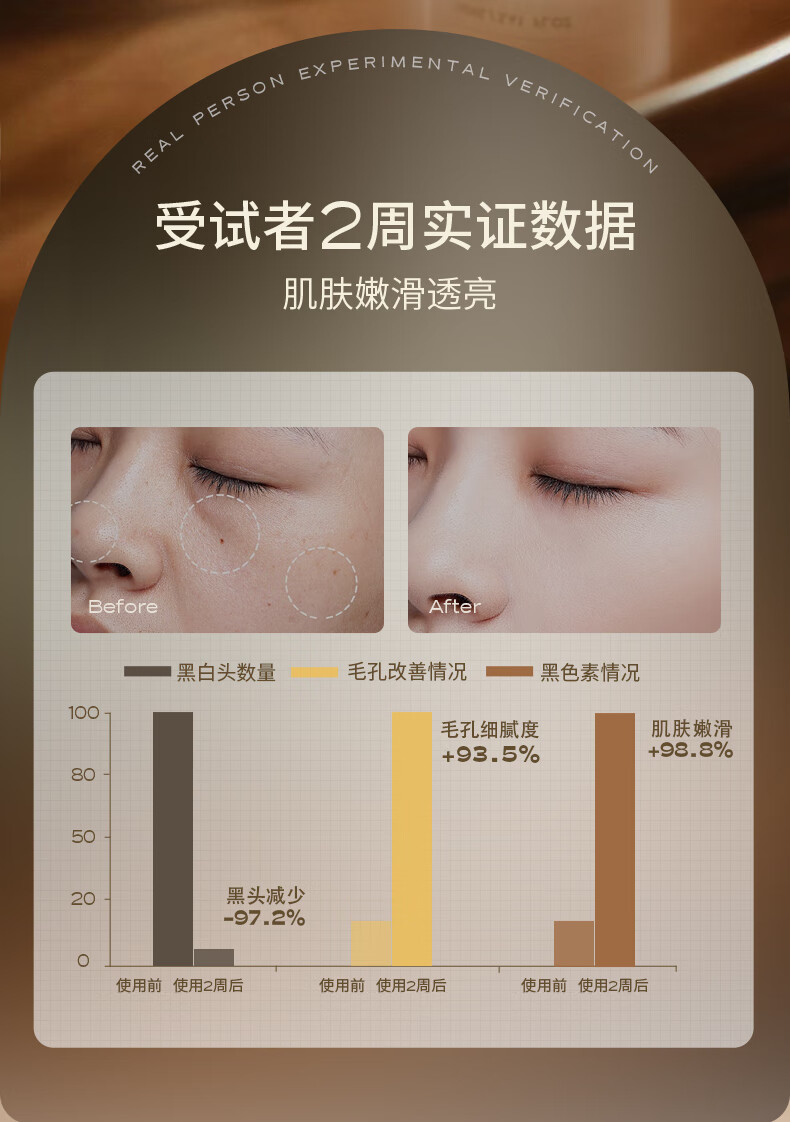 INSRE英国进口去黑头角质死皮面部深层清洁收缩毛孔男女士洁面啫喱膏 面部去角质