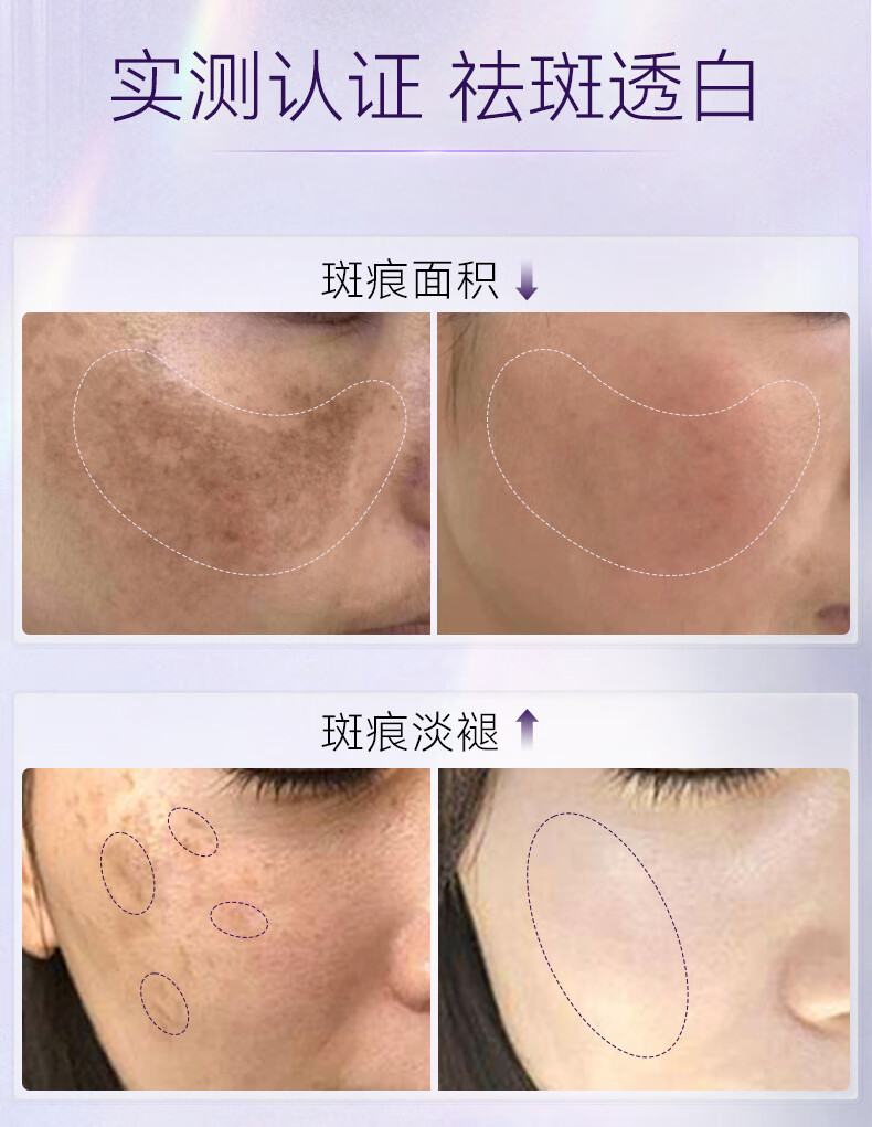 RSAS祛斑美白精华 雀斑老年斑晒斑黑斑黄褐斑 淡化斑点黑色素提亮肤色 祛斑美白精华30ml