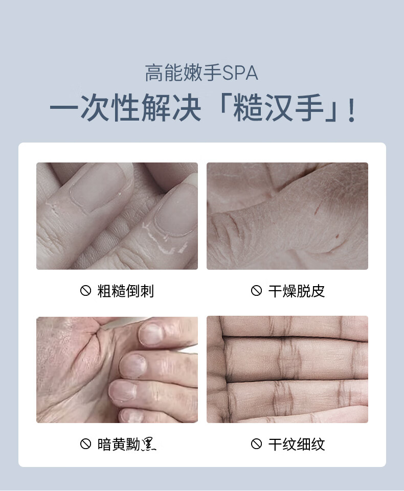 SUMDOY 日本进口烟酰胺美白嫩白手膜保湿淡化细纹手部保养手膜补水嫩滑 嫩白滋养手膜【买一 送一】