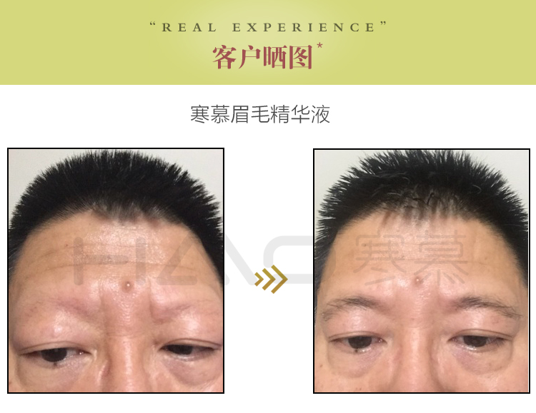 寒慕眉毛精华液男一字浓眉剑眉营养植萃液女自然浓密温和滋润乌黑养眉 【眉毛液2支装】男女通用