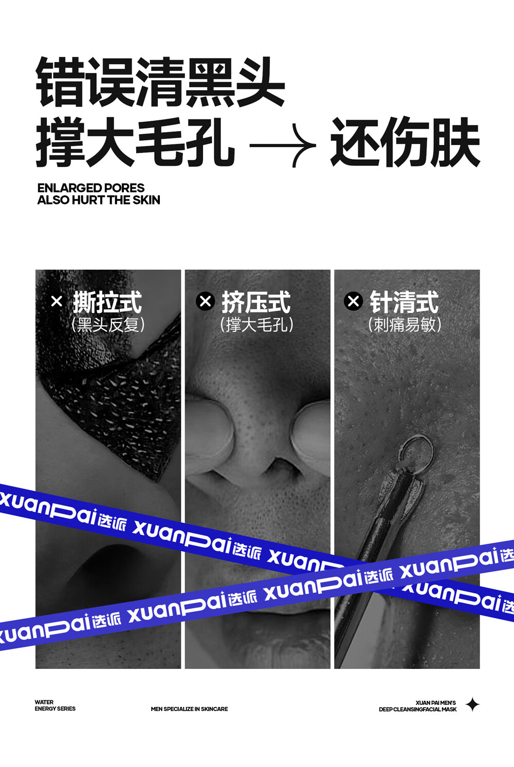 选派男士鼻贴黑头粉刺清洁毛孔男女草莓鼻 1盒装 2盒装