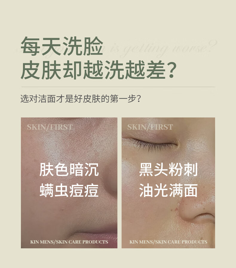 SKISGEM原装进口洗面奶除螨虫祛痘去黑头粉刺氨基酸控油男女士洁面慕斯 【灭螨清痘】洁面慕斯120ml