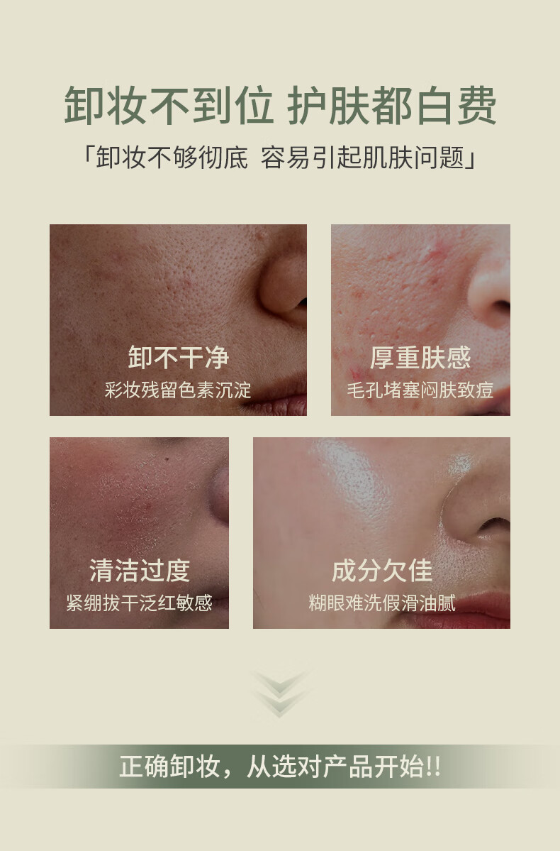 SKISGEM进口卸妆膏瞬间乳化眼唇卸妆深层清洁细致毛孔温和不闷痘敏感肌 温和不闷痘卸妆膏100g