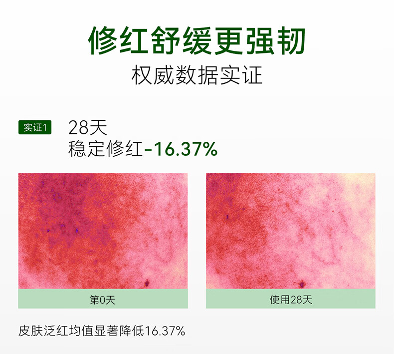 安修泽（ONCUR）油橄榄水 补水保湿干皮油皮女护肤精华爽肤水 150ml