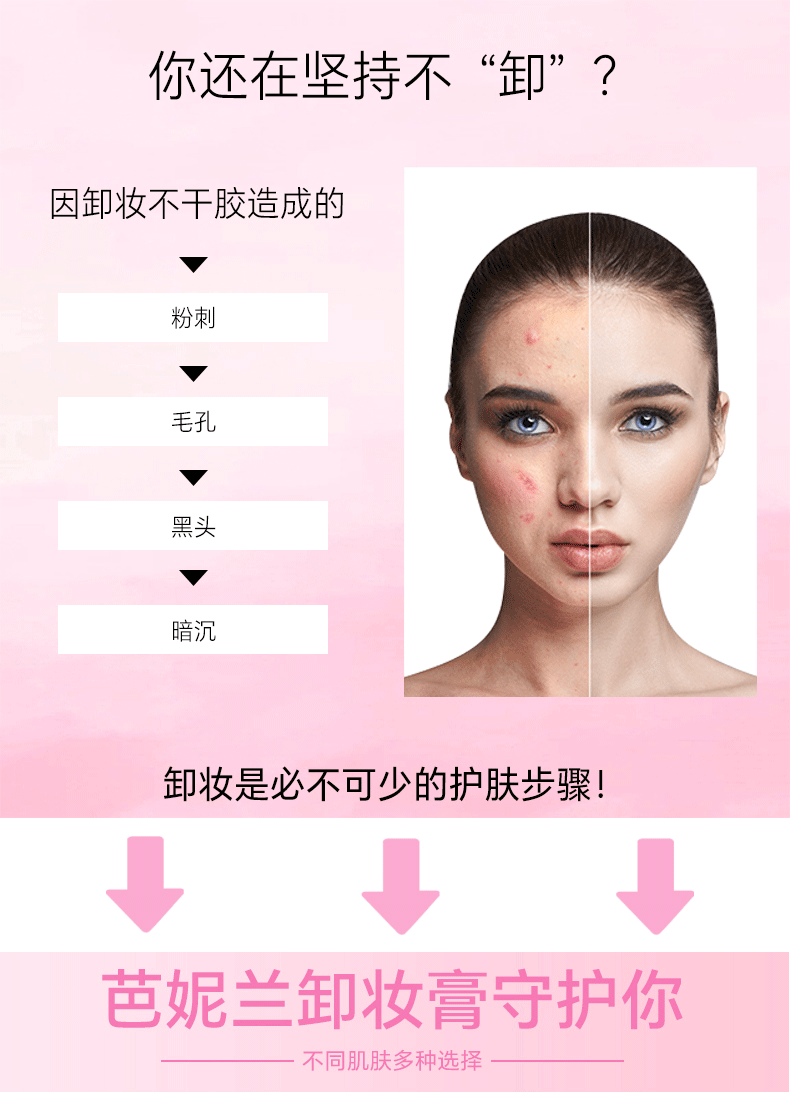 芭妮兰（banila co）Zero净柔卸妆膏秒乳化温和无刺激深层清洁脸部眼唇可用快速卸妆乳 经典款大容量（180ml）