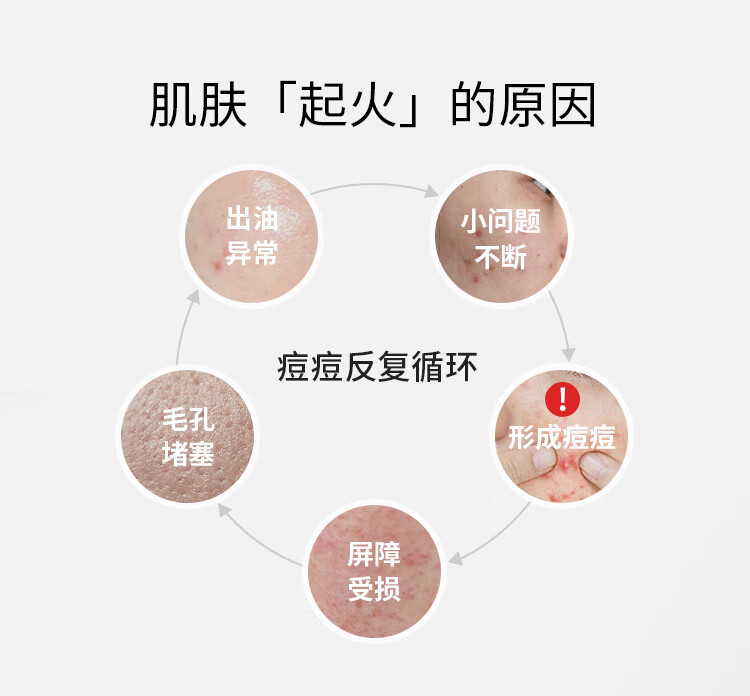 歌如兰祛痘修复面膜收缩毛孔修红淡化痘印舒缓控油急救烟酰胺买贵双倍赔 【优选】1盒(10片加赠2片)