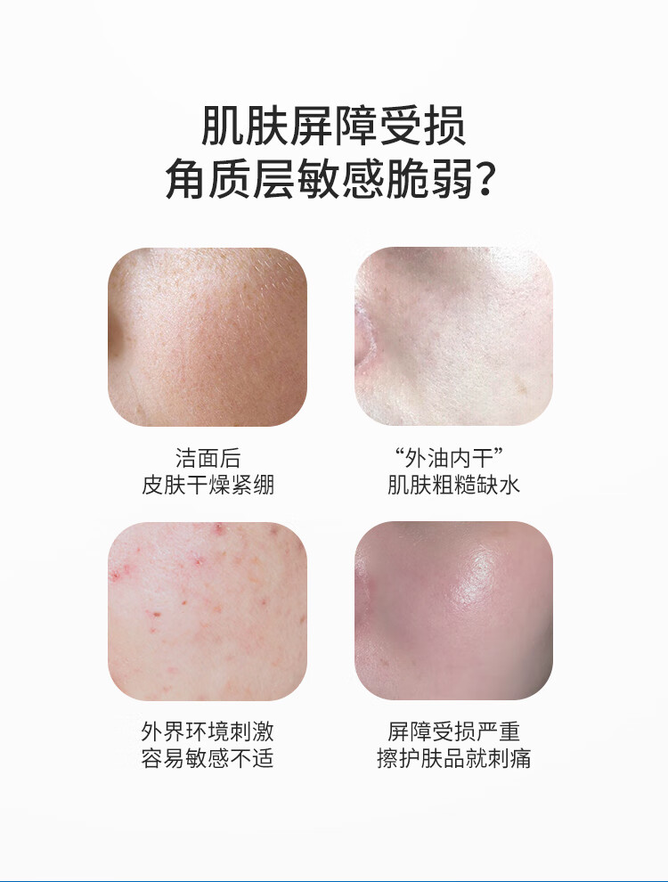 皮宝 舒缓修护柔肤水30ml补水保湿修护屏障补水锁水