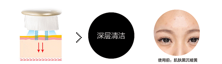 skg 3153 声波高频洁面仪