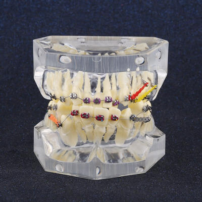 Greensen Dental Orthodontic Treatment Malocclusion Study Teeth Model With Wire Chain
Greensen Dental Orthodontic Treatment Malocclusion Study Teeth Model With Wire Chain