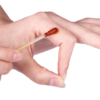 Merlot Merope iodine cotton swabs alcohol cotton swabs disinfectant sterilization nursing cotton swabs alcohol cotton swab mixed with 50 of 100
Merlot Merope iodine cotton swabs alcohol cotton swabs disinfectant sterilization nursing cotton swabs alcohol cotton swab mixed with 50 of 100