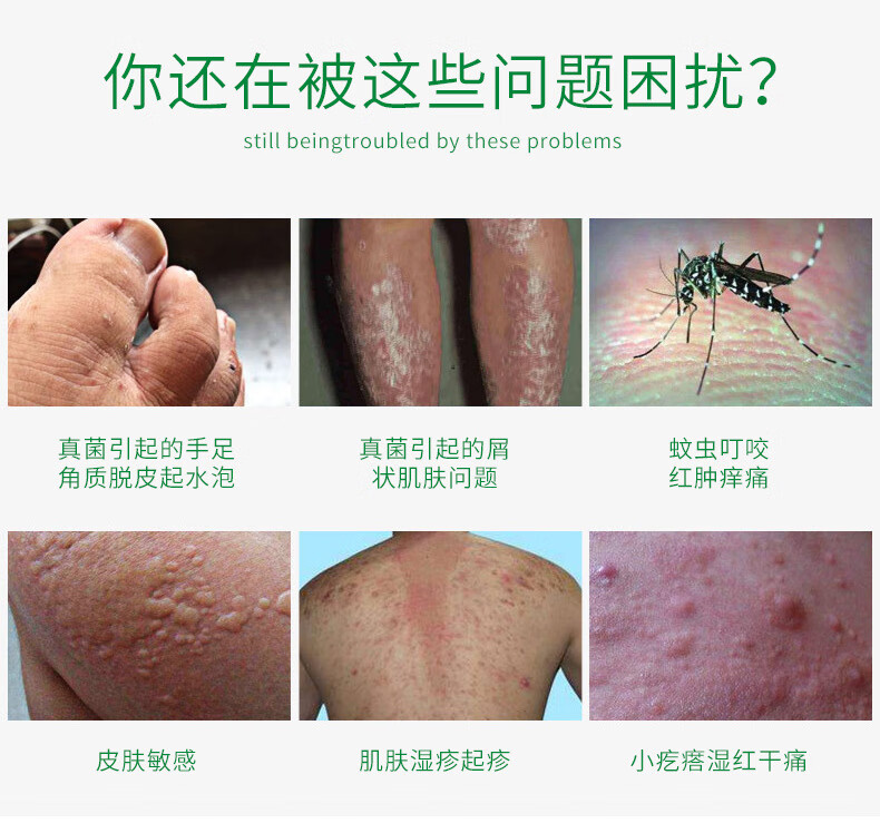 【专营优品】澳福来白斑膏妇科外阴白斑清爽私处瘙痒止痒膏