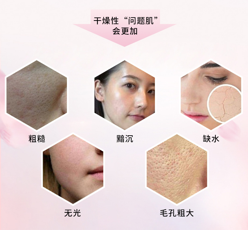 玫琳凯经典基础1号系列补水保湿细致毛孔暗沉肌肤提亮肤色女士 1号柔性洗面奶