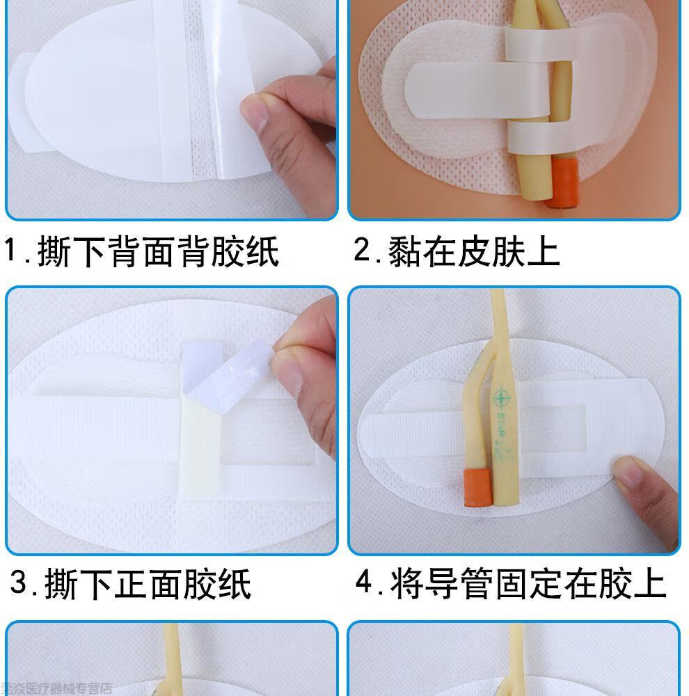 导尿管引流管picc导管固定贴体表导管固定装置 10片装