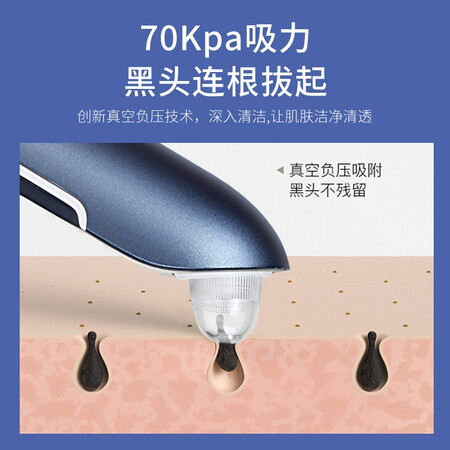 Golden Rice K-SKIN Visual Blackhead Apparatus Beauty Apparatus Vacuum Blackhead Exporter Pore Cleaner 30W Pixel Portable Household KD803P Deep Blue Golden Rice K-SKIN Visual Blackhead Apparatus Beauty Apparatus Vacuum Blackhead Exporter Pore Cleaner 30W Pixel Portable Household KD803P Deep Blue