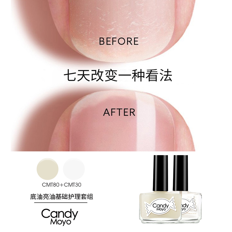 膜玉(candymoyo)指甲油底油亮油护甲基础美甲强韧护理加钙底油持久免图片