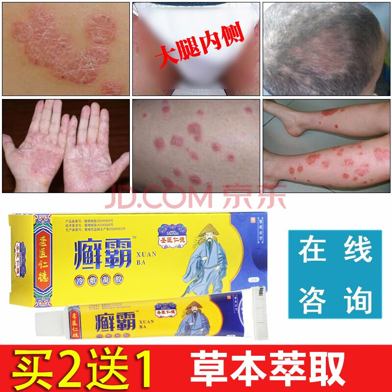 顽藓净癣王肤专家大腿内侧瘙痒股癣膏牛癣皮痒灵体癣手足癣脚癣立克屁