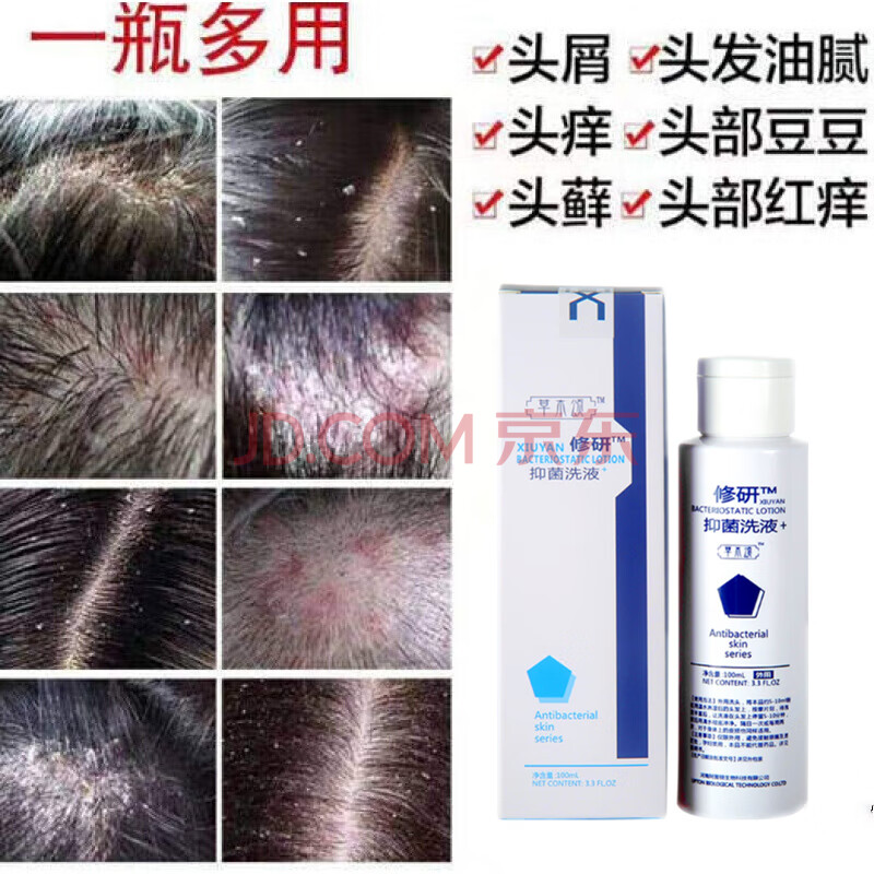 毛囊痒yi菌洗液治头皮屑头部癣藓头皮痒头发毛囊痒炎头部洗发发痒洗液