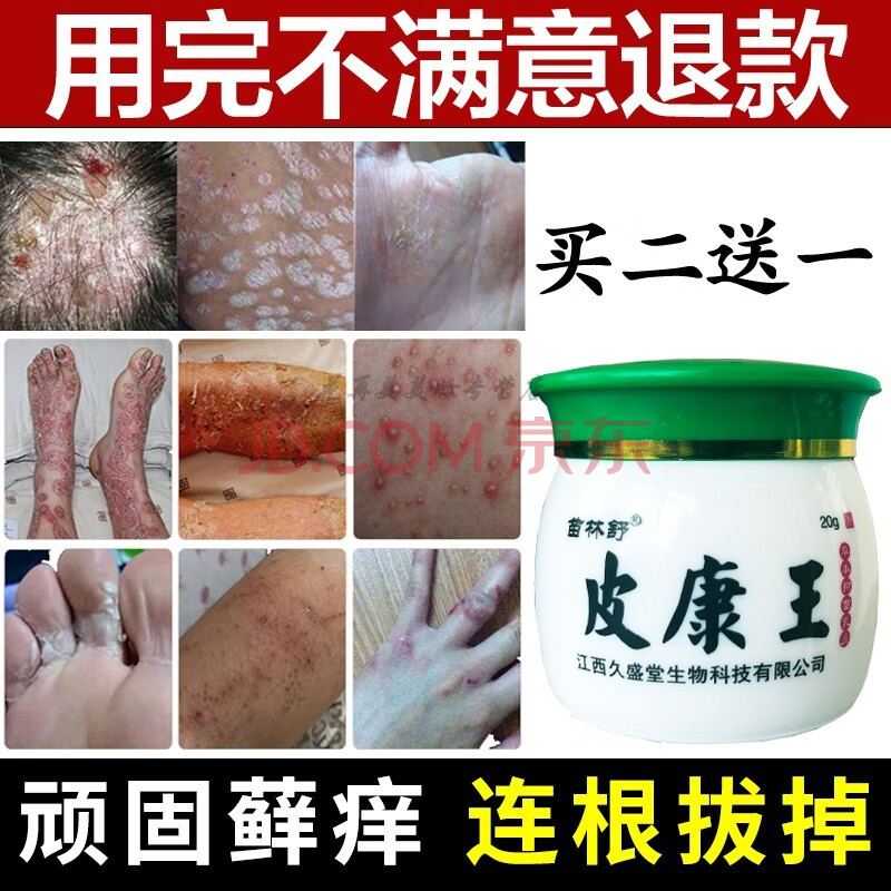 糖皮质激素软膏皮康王皮肤外用大腿内侧阴囊私处瘙痒痒过敏止痒廯痒净