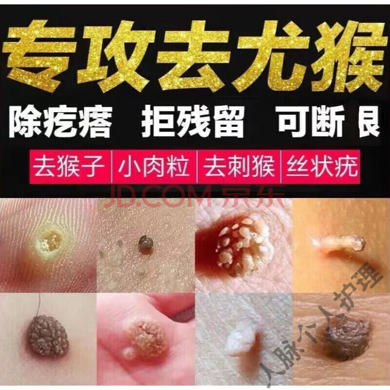 尤滴优去鸡i眼膏猴瘊i子老鼠贴除跖i疣鸦胆子血胞刺泡肉粒疙瘩根訷器