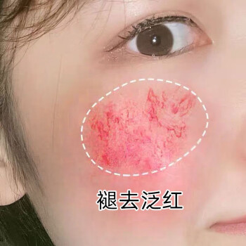敏感肌肤专用特护面霜去淡化红血丝护肤品修护复角质层泛红干痒男女士