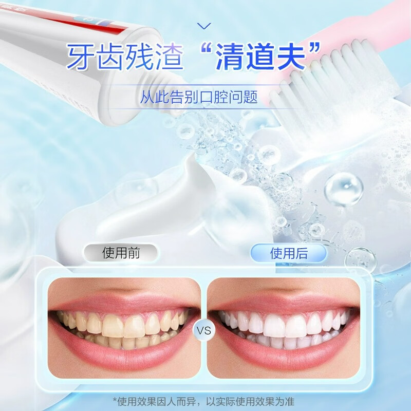 花王（KAO）日本进口牙膏165g*3支 固齿护牙龈 除口腔异味清新口气薄荷牙膏