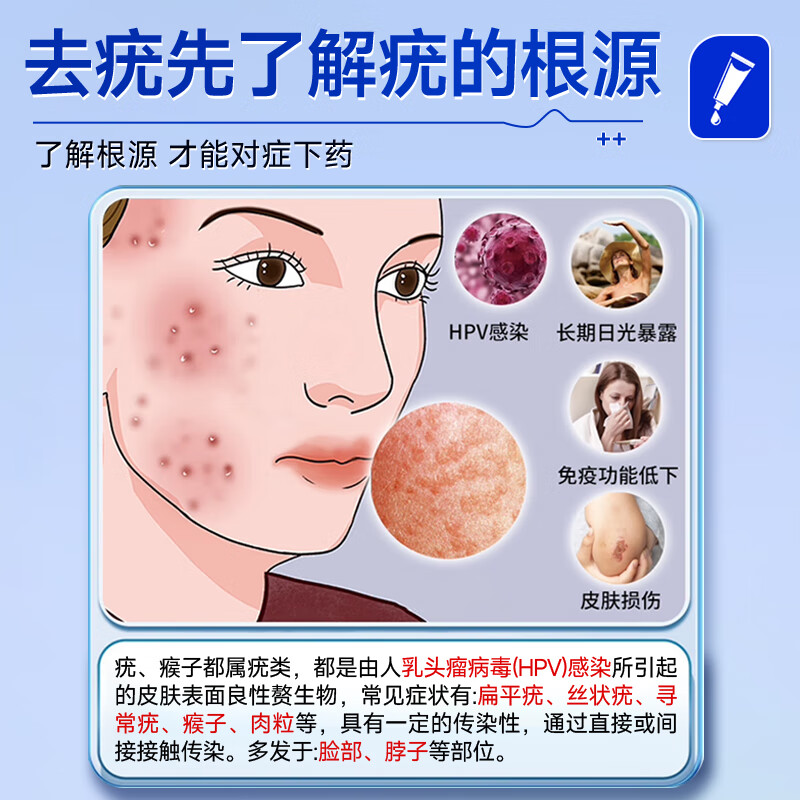 廾卜制药疣体脱落膏扁平疣专用丝状疣尖锐湿疣跖疣颈部疣瘊灵小肉粒疣克疣