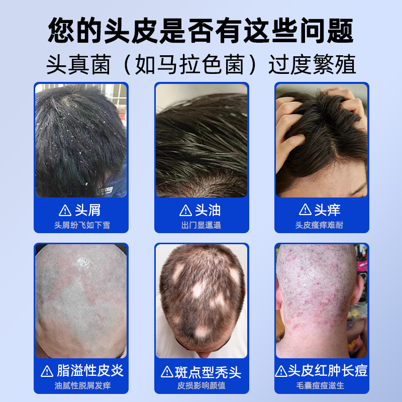 千极药业煤焦油洗剂洗发水脂溢性头皮止痒抑菌马拉色菌去屑洗发保健200ml