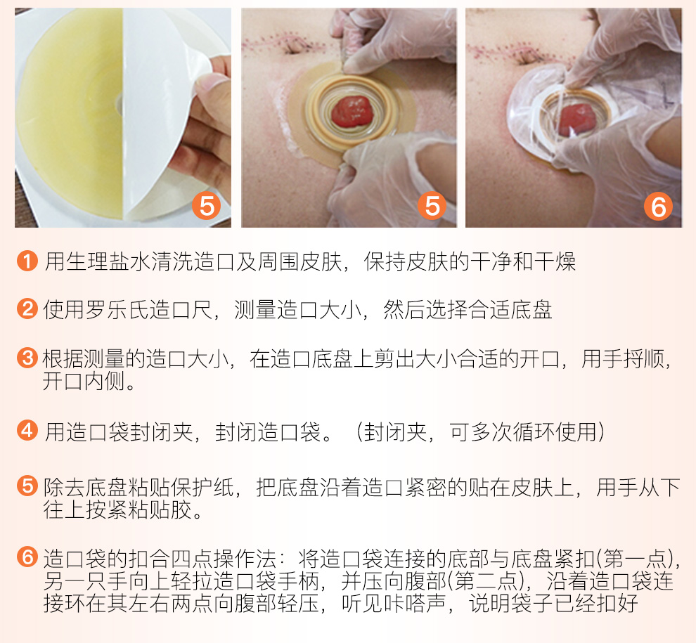 罗乐氏造口袋 二件式造口袋 造口护理用品 10个二件式造口袋 2个底盘