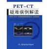 

PET-CT疑难病例解读