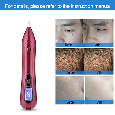 

Greensen LCD Screen Spot Removal Pen USB Freckle Spot Mole Tattoo Removal Pen Skin Repair Beauty Machine