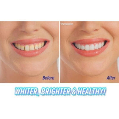 

Hot new Sonic Pic Gentle Dental Teeth Whiten Ultrasonic Dental Tooth Pick With LED Light