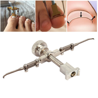 

Greensen Ingrown Toe Nail Recover Correction ToolIngrown Toe Nail Recover Correction Tool Pedicure Toenail Fixer Foot Nail Care