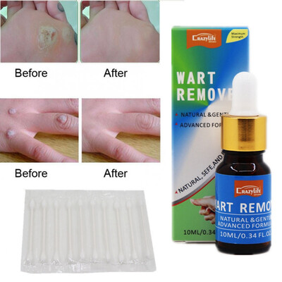 

Remove Old Dead Skin Whitening Beauty Skin Care Solution 10ml