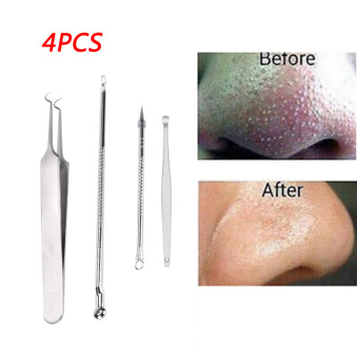 

〖Follure〗Stainless Blackhead Facial Acne Spot Pimple Remover Ear Extractor Tool Comedone