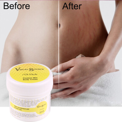 

Smooth Skin Cream For Stretch Marks Scar Removal To Maternity Skin Repair Body Cream Remove Scar Care
