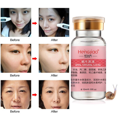 

10ml Face Care Anti Aging Remove Wrinkles Serum Moisturizing Argireline Snail Nourishing Concentrate Firming Skin Whitening