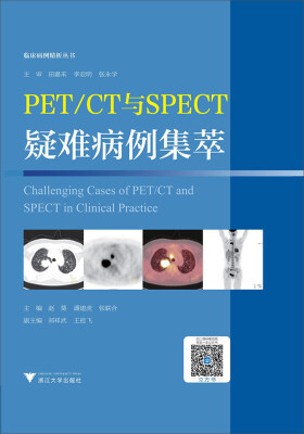 

PET/CT与SPECT疑难病例集萃 临床精析病例集锦