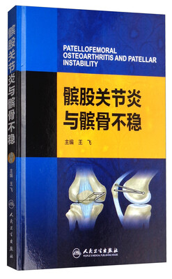 

髌股关节炎与髌骨不稳