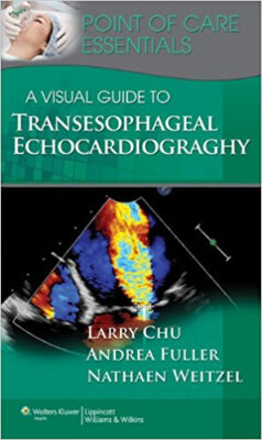 

A Visual Guide to Transesophageal Echocardiograp