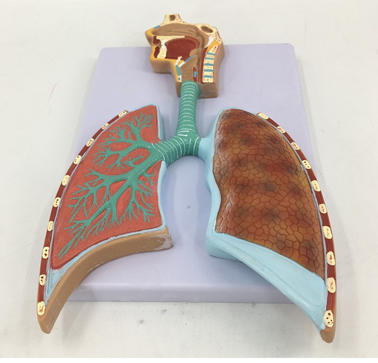 人体呼吸解剖模型肺解剖呼吸浮雕模型肺泡放大解剖模型a款肺泡放大