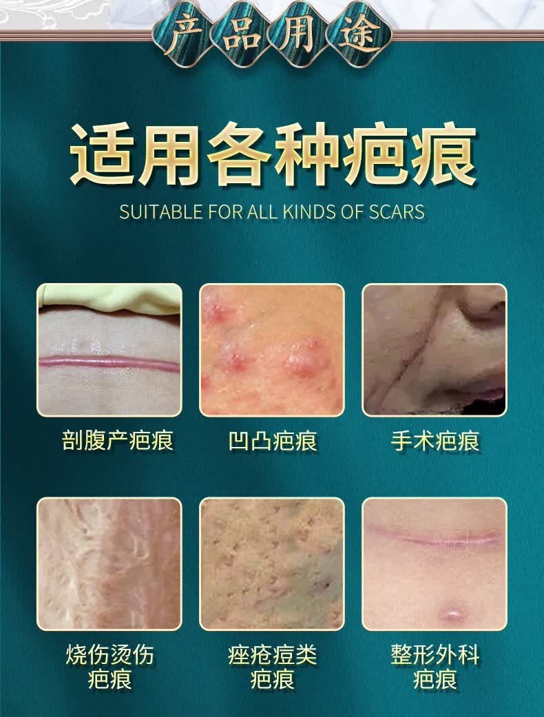 云南白药泰邦疤痕凝胶抑制减轻烧伤外伤手术引起的增生性疤痕去祛凝胶