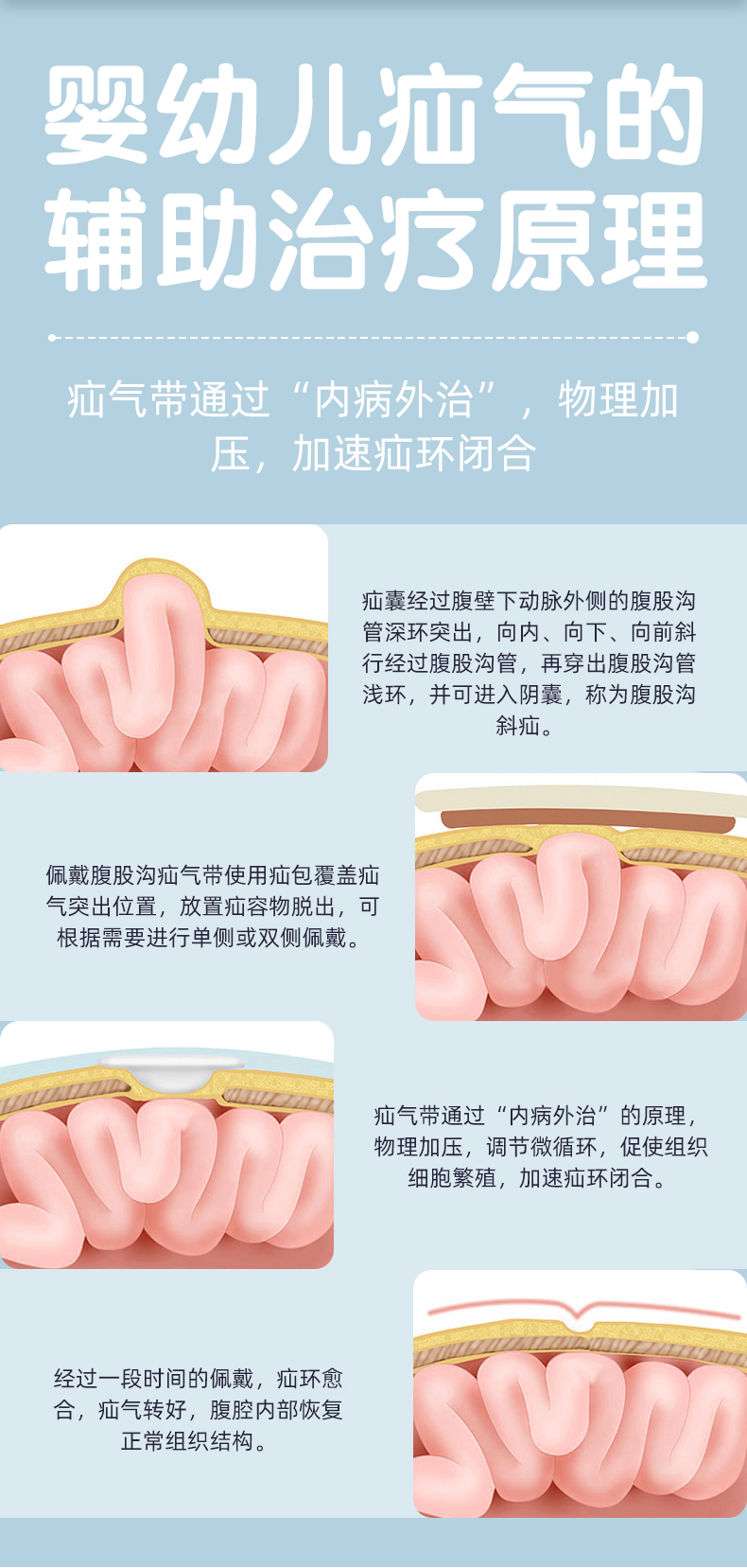 疝气带婴儿小儿人男性成年老人小肠气贴袋成人款全家福套装带2条疝气