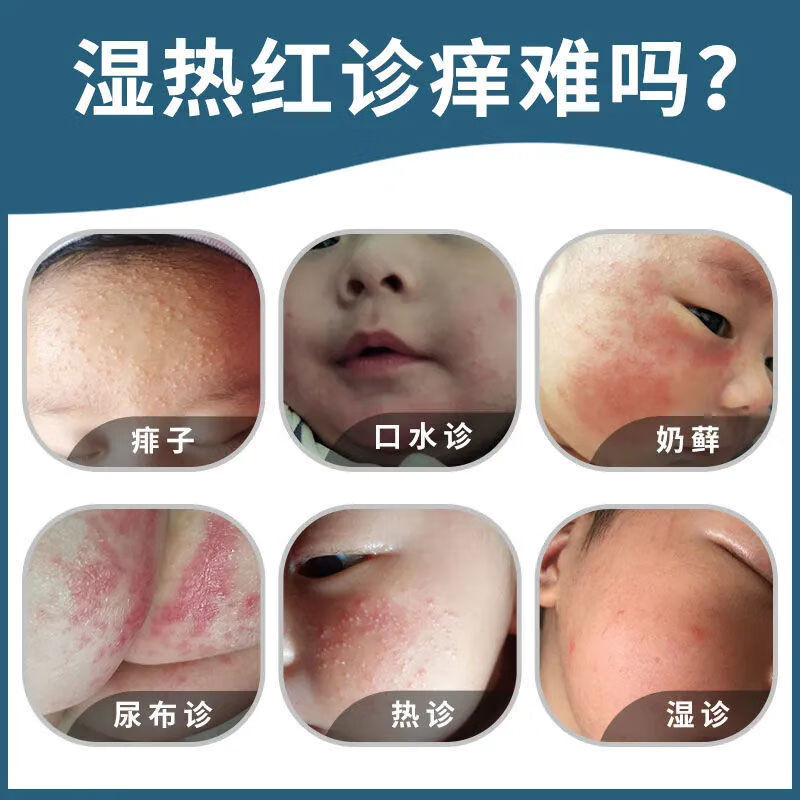 幼然护臀膏婴宝护肤霜宝宝瘙痒蚊虫叮咬消肿止痒儿童癣红屁屁护臀膏